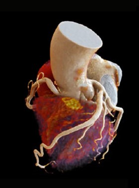 Medical Imaging